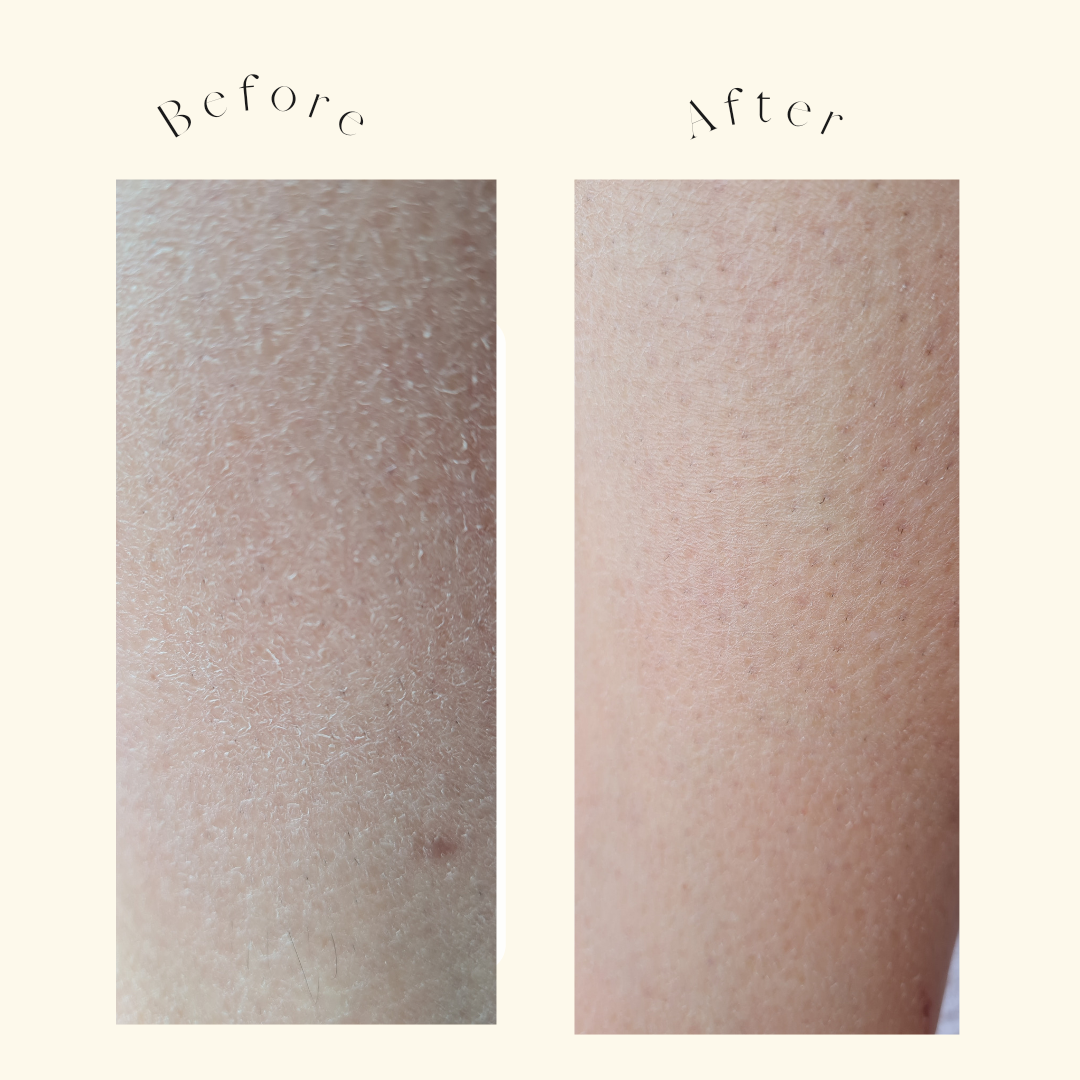 Before and after using body exfoliating mitt Atypical.eco